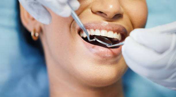 Best Emergency Dentist for Lost Fillings or Crowns in Silver Springs, FL